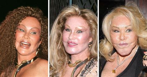 jocelyn wildenstein before.